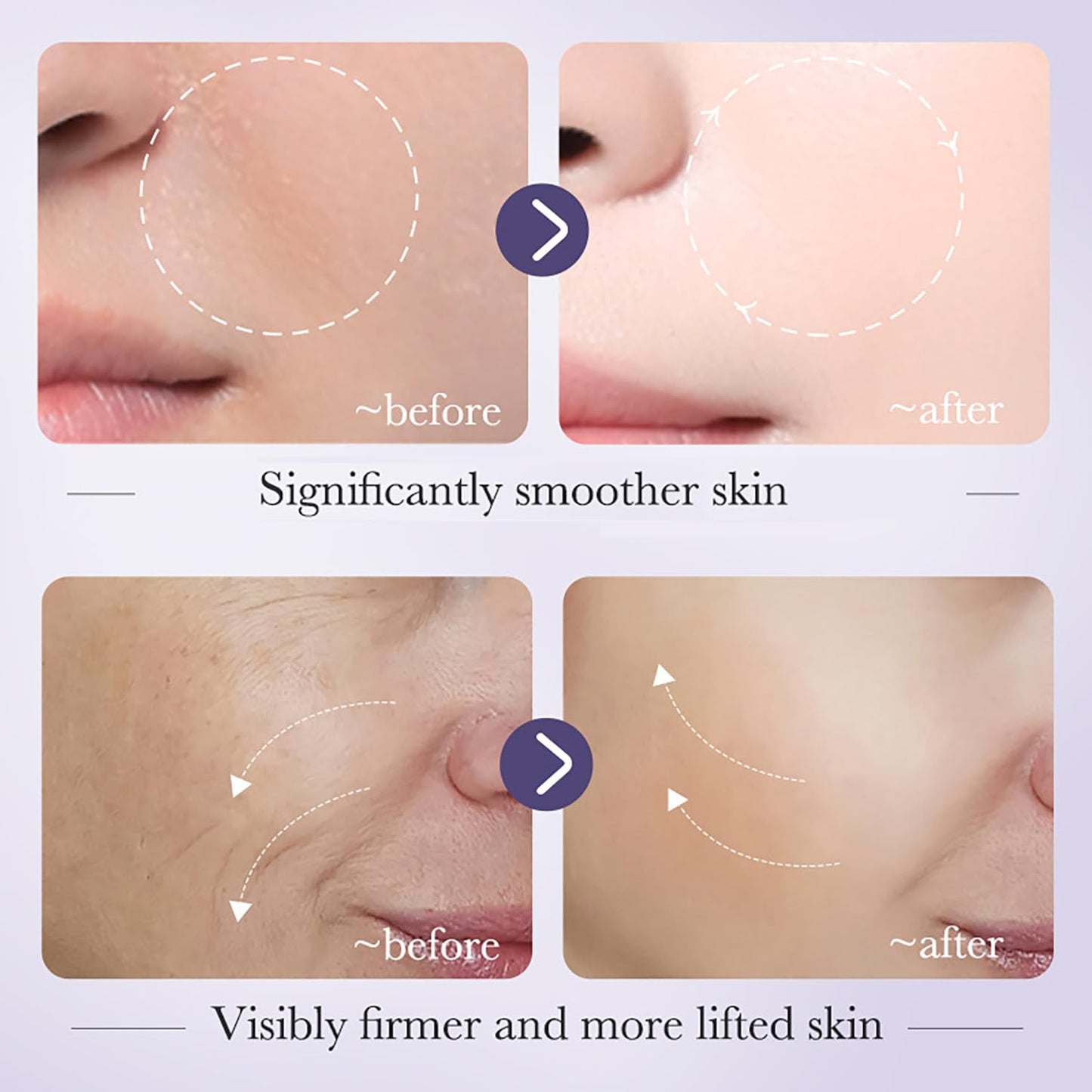 Anti-Wrinkle & Anti-Aging Retinol Serum